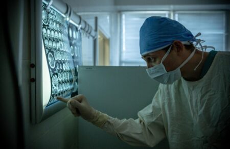 meleti-oi-psychodrastikes-oysies-syndeontai-me-ton-kindyno-egkefalikoy-epeisodioy-akoma-kai-se-neoys-680050