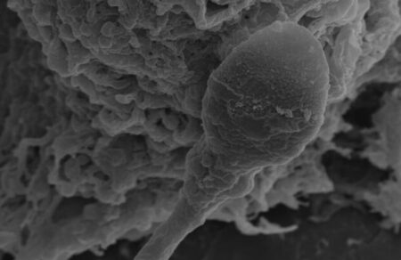 sex-sto-diastima-nea-dedomena-deichnoyn-oti-to-sperma-chanei-ton-prosanatolismo-toy-742453