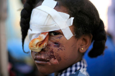 Αϊτή, μια διεθνής ντροπή. Του Σ.Κούλογλου
