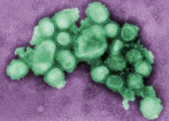 Υπό παρακολούθηση κρούσματα της νέας γρίπης στη Δ/νση Αλλοδαπών