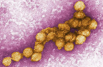 Απεβίωσε 80χρονος, το τρίτο θύμα του “ιού του Δυτικού Νείλου”