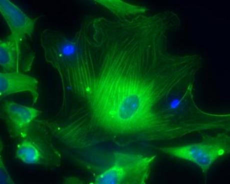 ΗΠΑ: «Όχι» στη χρηματοδότηση των ερευνών για ανθρώπινα αρχέγονα κύτταρα