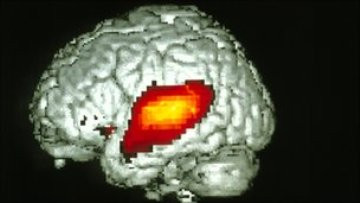 Ο εγκέφαλος των εκ γενετής κουφών «επαναπρογραμματίζεται» για να βελτιώσει την όραση
