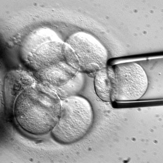 Νέα δοκιμή εμβρυϊκών βλαστοκυττάρων στις ΗΠΑ