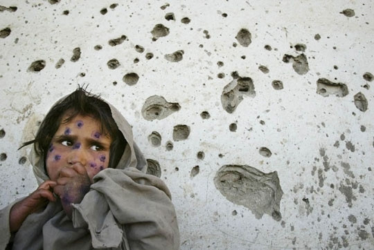 ΟΗΕ: Αύξηση 15% στους θανάτους αμάχων στο Αφγανιστάν το 2010