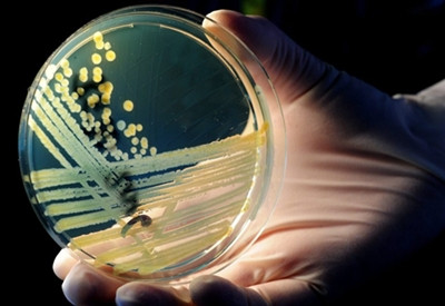 Άγνωστη παραμένει η πηγή μόλυνσης από το βακτηρίδιο EHEC