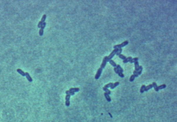 Εκατοντάδες νέα κρούσματα του βακτηριδίου E.coli