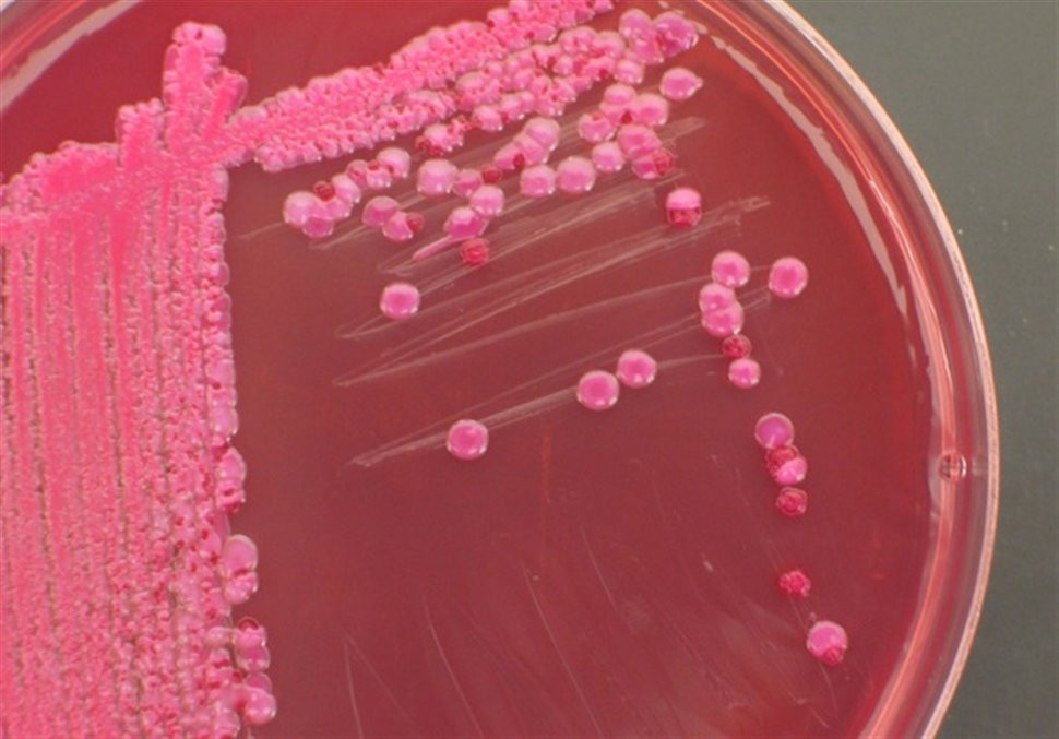 Άγνωστη παραμένει η πηγή του θανατηφόρου E.coli