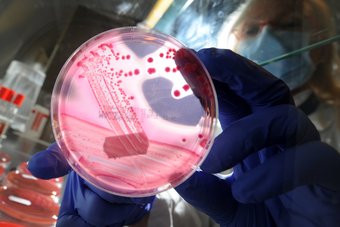 E.coli: Γερμανικές φύτρες φασολιών ο βασικός ύποπτος για την επιδημία