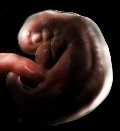 Δυσπλασίες του νευρικού σωλήνα των εμβρύων λόγω ρύπων