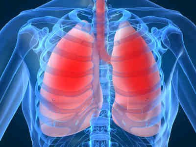 Βλαστοκύτταρα ενάντια στις σοβαρές και θανατηφόρες ασθένειες των πνευμόνων