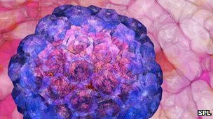 Μία στις έξι μορφές καρκίνου προκαλούνται από ιάσιμη λοίμωξη