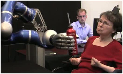 Παράλυτη ασθενής κίνησε ρομποτικό χέρι με τη σκέψη της