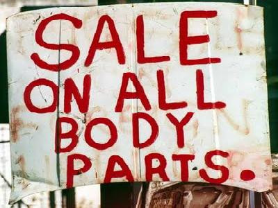 Ανθίζει το παράνομο εμπόριο νεφρών: Ένα νεφρό «πωλείται κάθε ώρα»