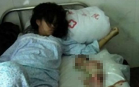 Σοκ προκαλεί η βίαιη άμβλωση σε έγκυο επτά μηνών στην Κίνα