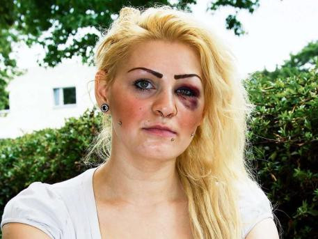 Ελληνογερμανίδα ξυλοκοπήθηκε μετά το Γερμανία – Ελλάδα
