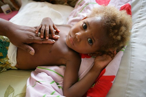 UNICEF: Κάθε 25 δευτερόλεπτα ένα παιδί πεθαίνει από πνευμονία