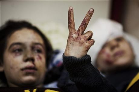 Θύματα του πολέμου 2.000.000 παιδιά στη Συρία