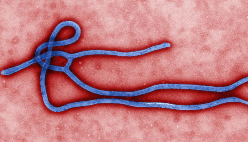 Οδηγίες του υπ. Υγείας για τον ιό Έμπολα