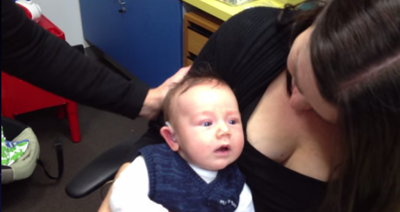 Η εκπληκτική αντίδραση ενός μωρού με προβλήματα ακοής που ακούει για πρώτη φορά