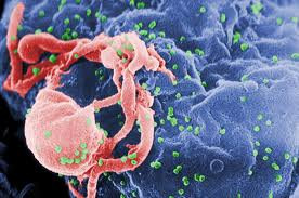 Ανακαλύφθηκε νέο, πιο επιθετικό στέλεχος του HIV