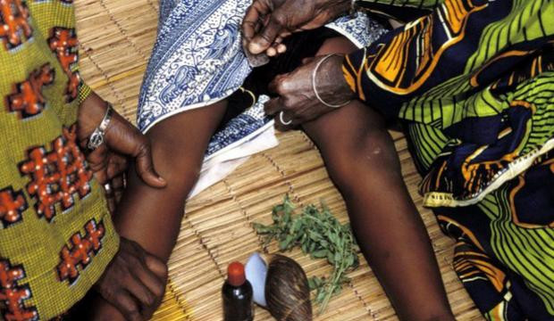 Η Νιγηρία απαγόρευσε την κλειτοριδεκτομή