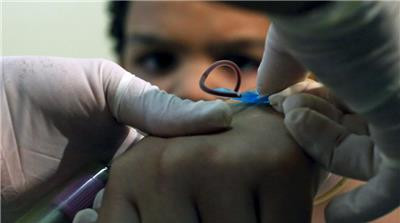 Πρώτο κρούσμα του ιού Ζίκα σε έγκυο στην Ευρώπη