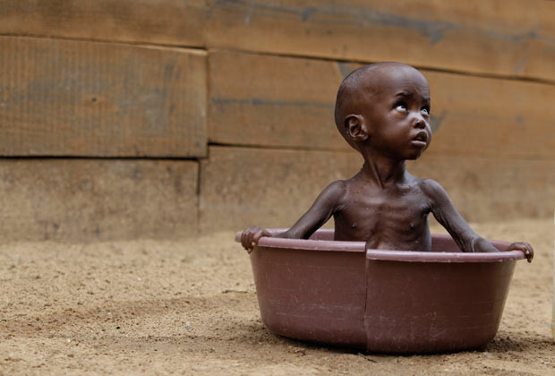 Σχεδόν 1.000.000 παιδιά είναι σοβαρά υποσιτισμένα στην Αφρική