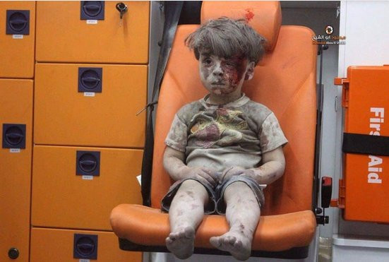 Η φρίκη του πολέμου στη Συρία σε μία εικόνα