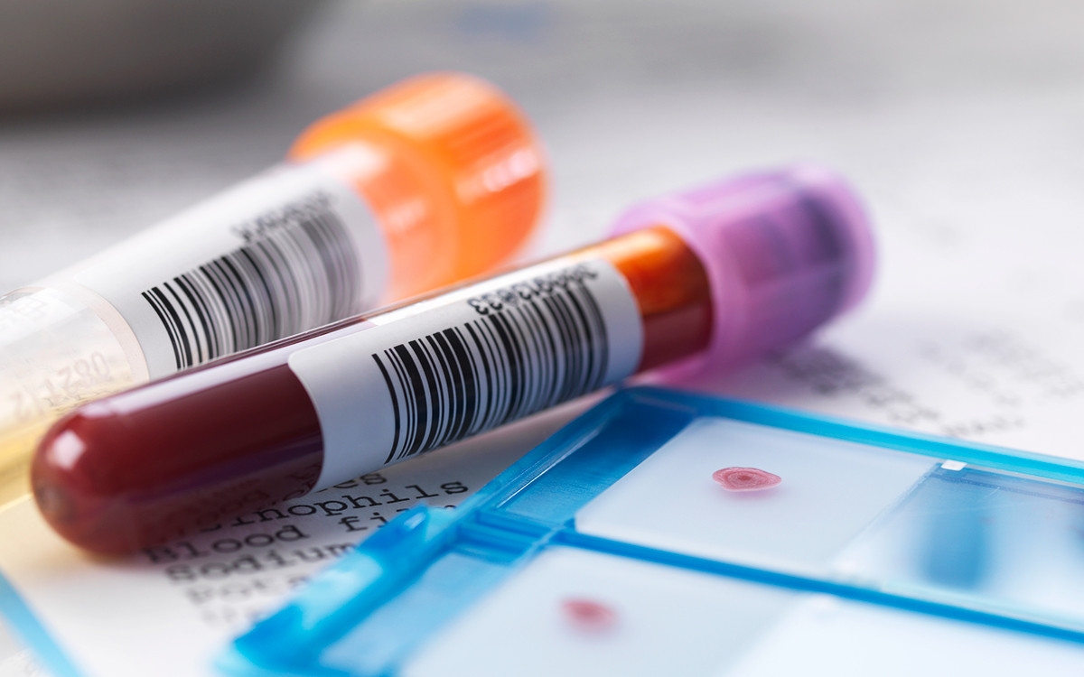 Νέο τεστ αίματος ανιχνεύει όχι μόνο τον καρκίνο, αλλά και πού αναπτύσσεται