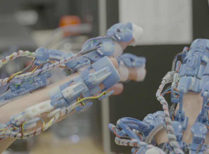 Ρομποτικό χέρι που… χειρουργεί κατασκευάζουν Έλληνες και ξένοι επιστήμονες