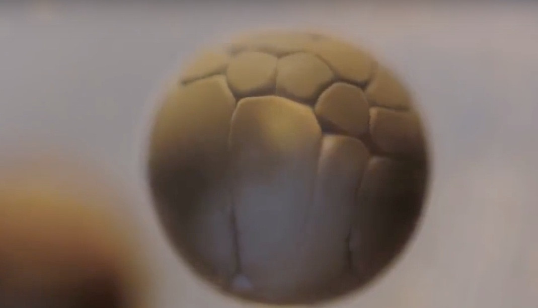 Δείτε σε ένα πρωτοποριακό βίντεο την διάσπαση του εμβρυακού κυττάρου!