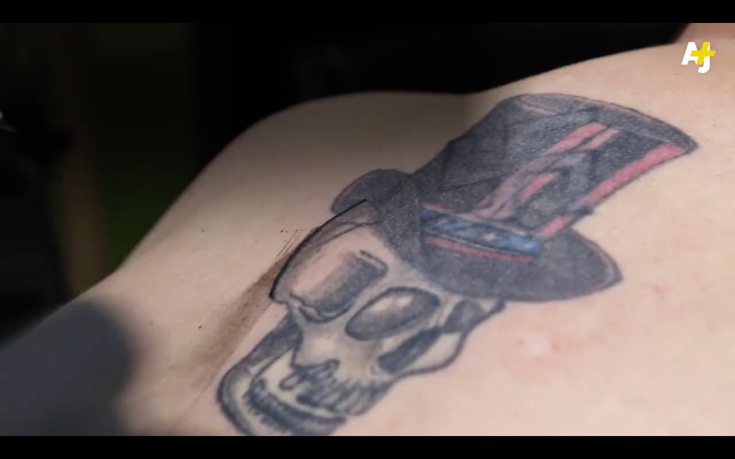 Αυτός ο tattoo artist αφαιρεί ρατσιστικά τατουάζ δωρεάν! [ΒΙΝΤΕΟ]