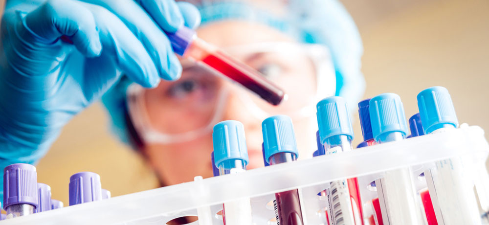 Νέο τεστ αίματος για ταχεία διάγνωση του καρκίνου