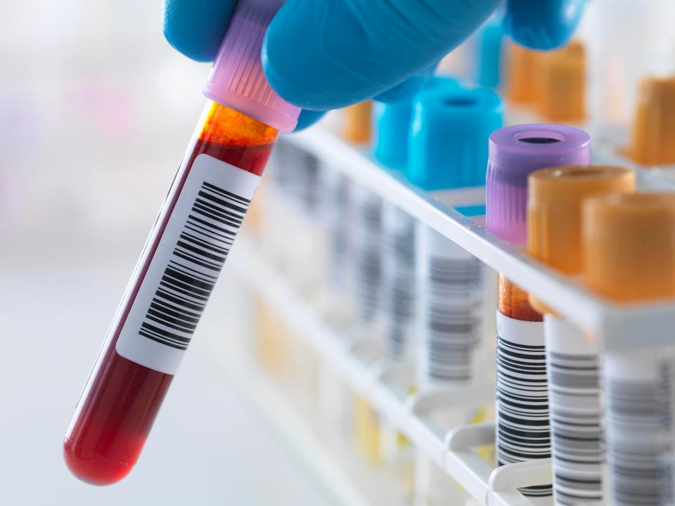 Νέο πολύ γρήγορο τεστ αίματος, αλλάζει τα δεδομένα για το έμφραγμα