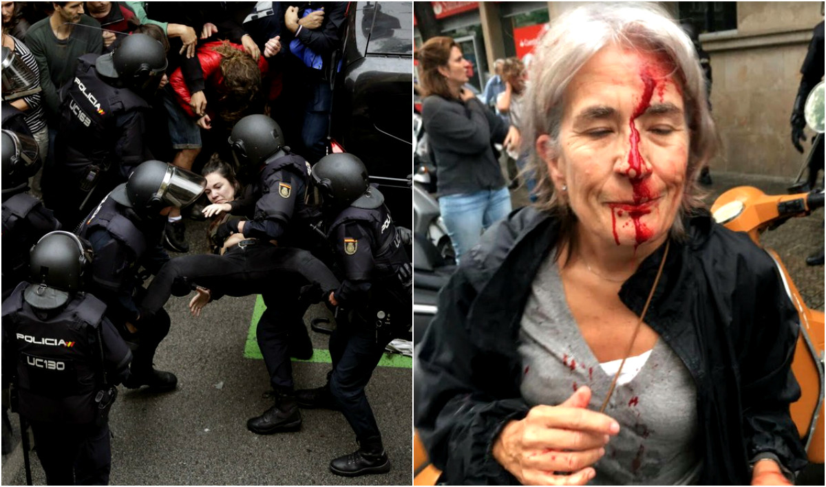Καταστολή στην Καταλονία: Πλαστικές σφαίρες, αίμα και εκατοντάδες τραυματίες