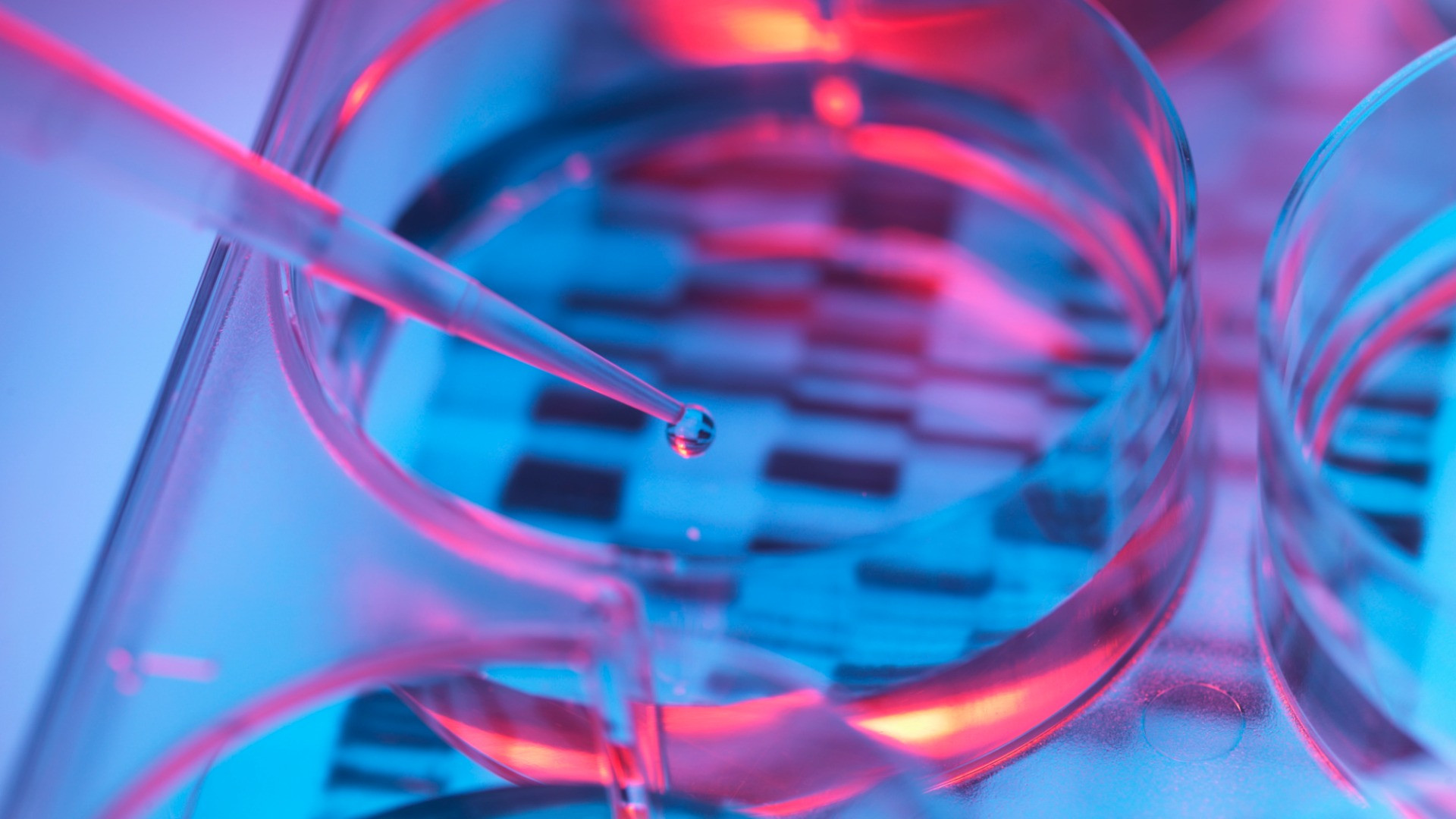 Αναπτύχθηκε ένα νέο προγεννητικό τεστ DNA για το σύνδρομο Ντάουν