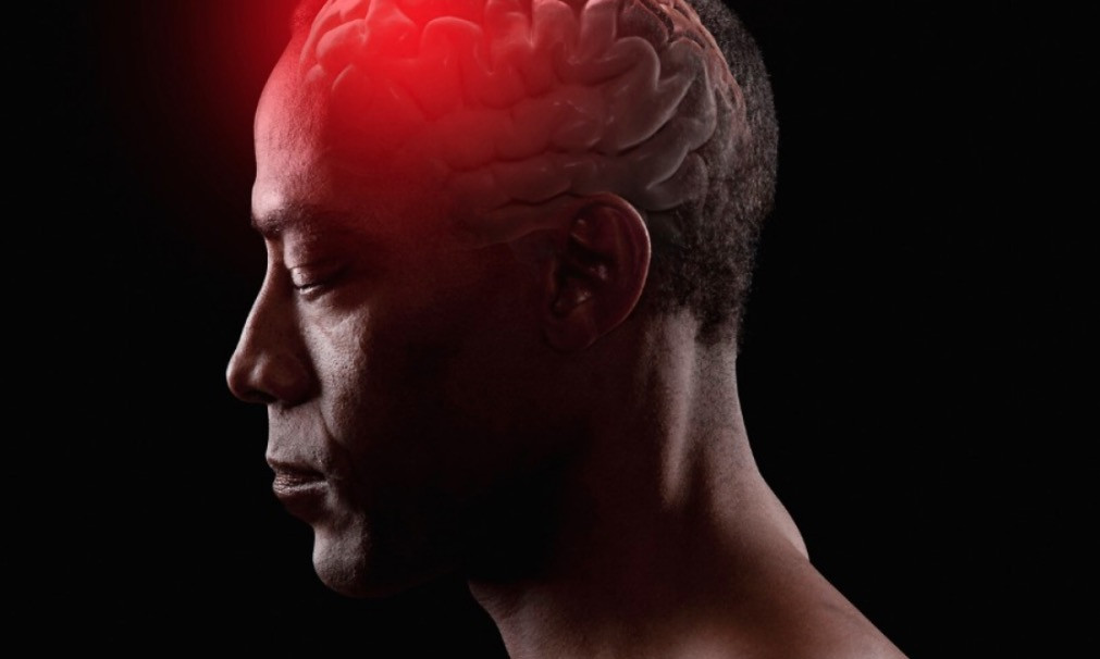 Ανεύρυσμα εγκεφάλου: Τα πρώτα συμπτώματα που δεν πρέπει να αγνοήσετε