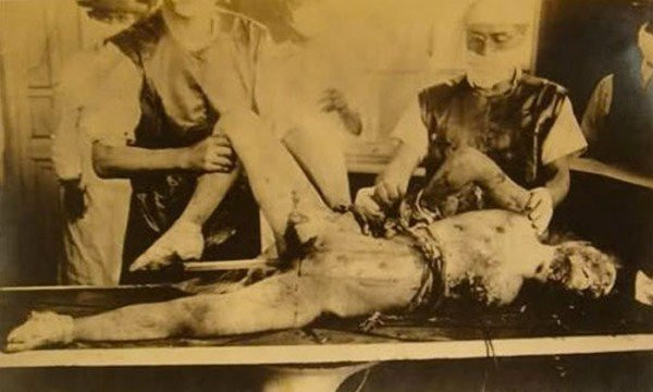 Μονάδα 731: Το πιο αποτρόπαιο έγκλημα του ανθρώπινου είδους