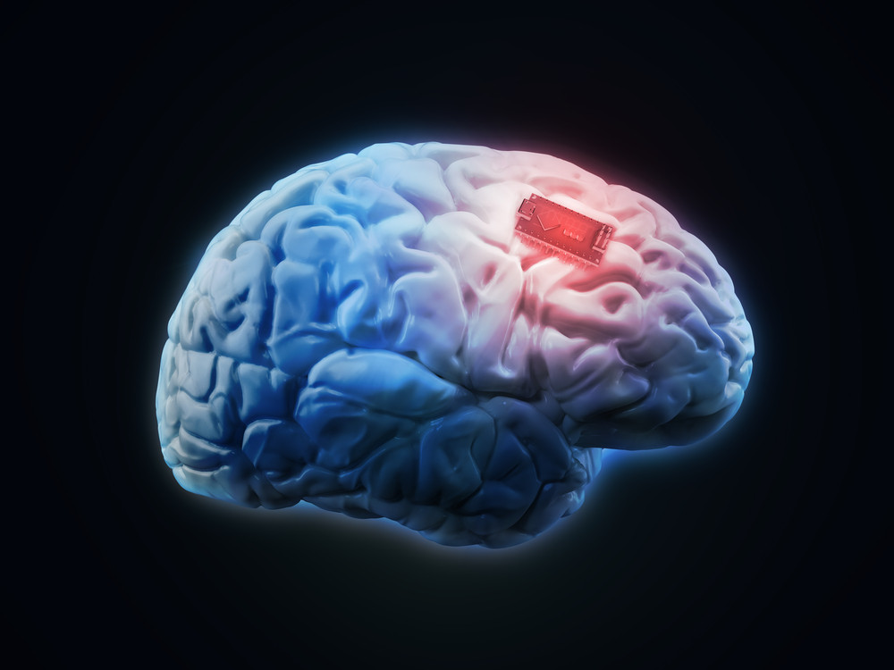 «Βηματοδότης» εγκεφάλου στην μάχη εναντίον του Αλτσχάιμερ