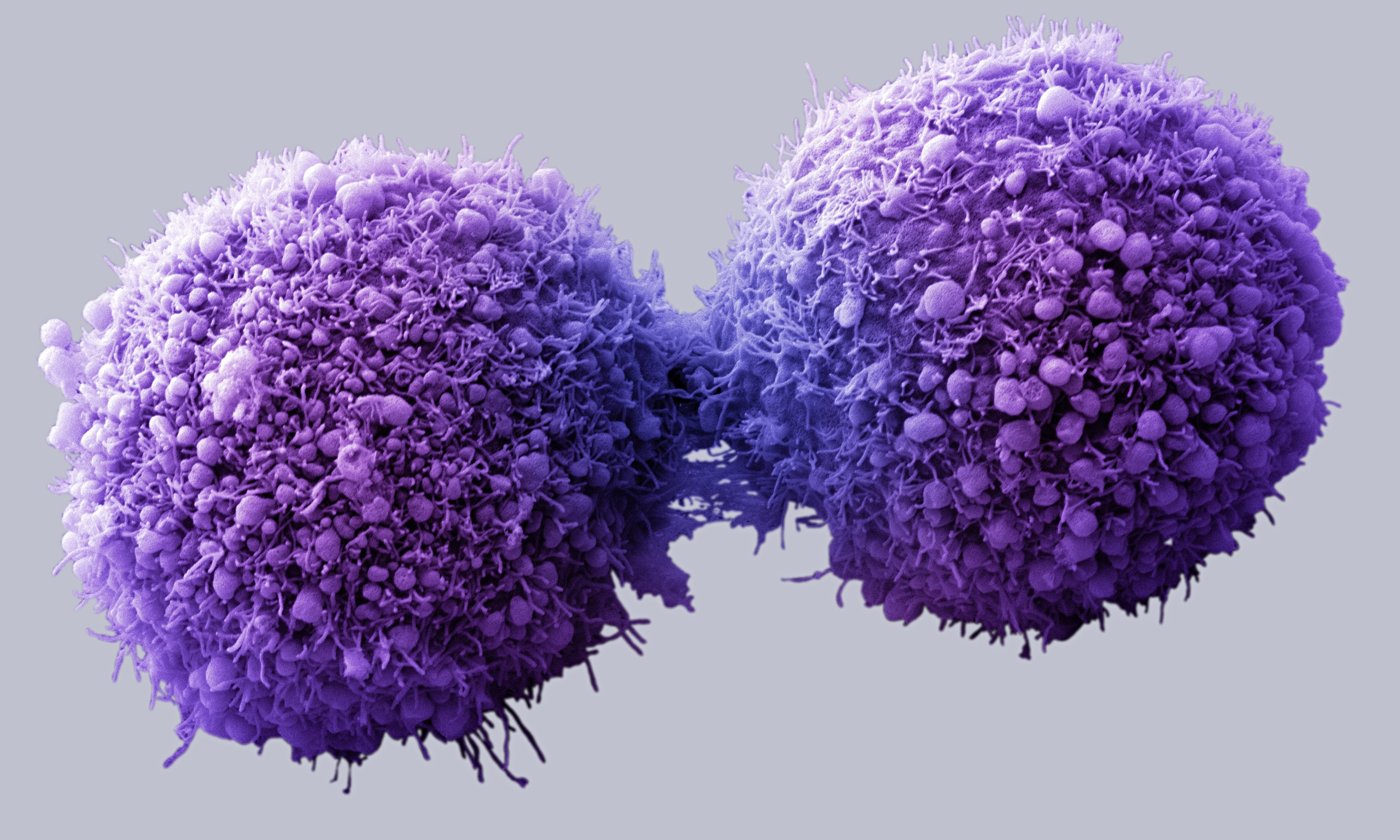 Αυτόνομα νανορομπότ εξοντώνουν καρκινικούς όγκους