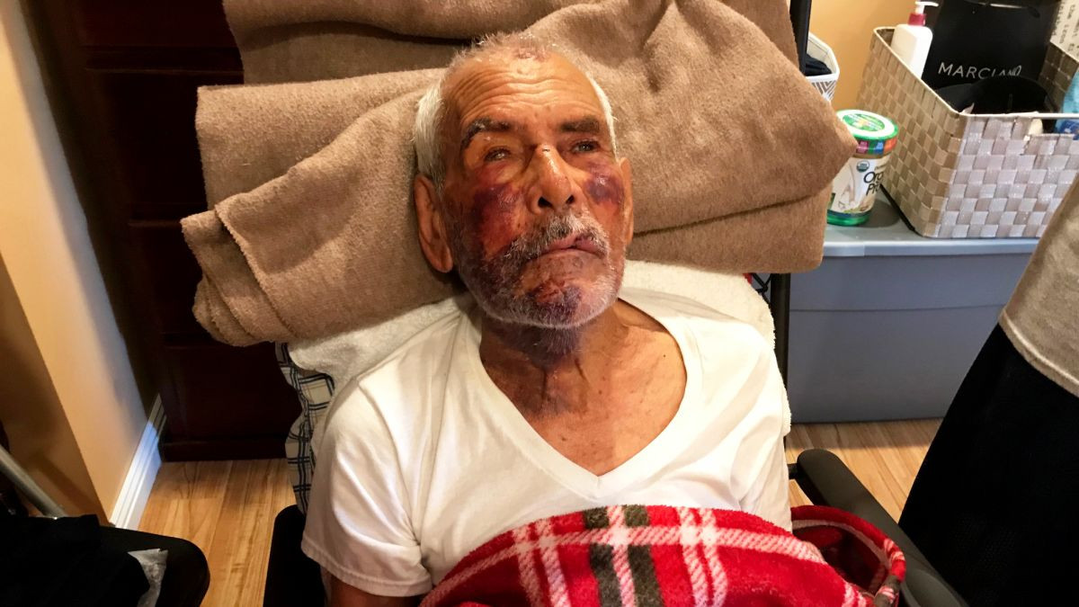 Ρατσιστική επίθεση σε 91χρονο Μεξικανό στις ΗΠΑ [Βίντεο]
