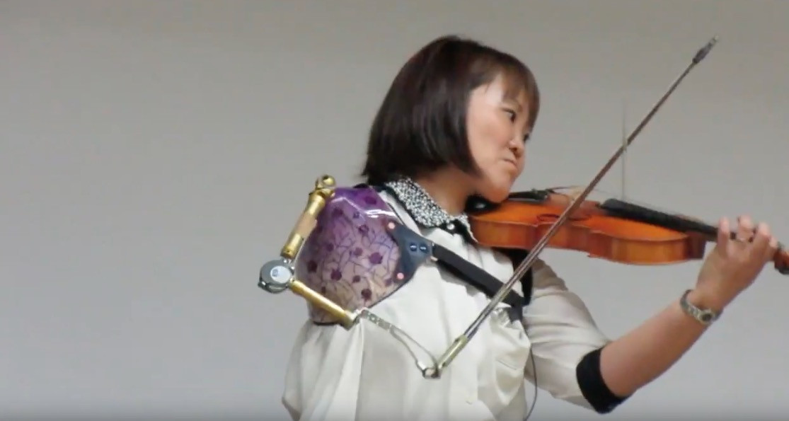 Πηγή έμπνευσης: Παίζει κλασικό βιολί με τεχνητό μπράτσο [ΒΙΝΤΕΟ]
