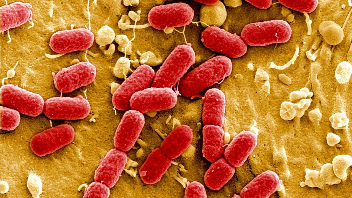 Τα σούπερ-μικρόβια κοστίζουν ακριβά σε ζωές και σε δαπάνες