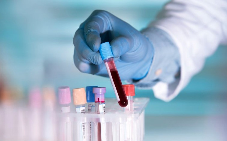 Νέο τεστ αίματος ανιχνεύει οποιονδήποτε καρκίνο μέσα σε δέκα λεπτά