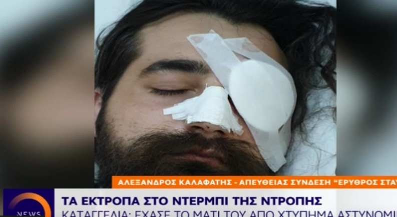 Επεισόδια ΟΑΚΑ: Άνδρας έχασε το μάτι του από χτύπημα αστυνομικού