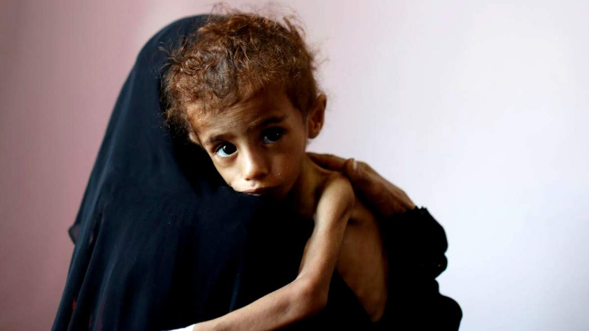Υεμένη: Οκτώ παιδιά σκοτώνονται ή τραυματίζονται κάθε μέρα