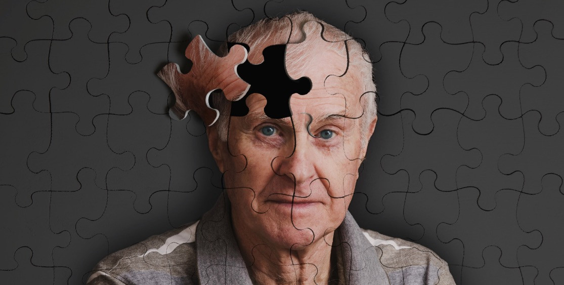 Πως συνδέεται η «κακή» χοληστερίνη με το Αλτσχάιμερ