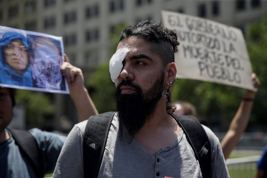 «Όντως στη Χιλή βρισκόμαστε σε πόλεμο»: Στους δρόμους διαδηλωτές που τραυματίστηκαν στα μάτια