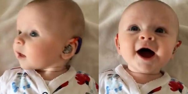 Μωράκι με σοβαρή κώφωση ακούει τη φωνή της μητέρας του [Βίντεο]